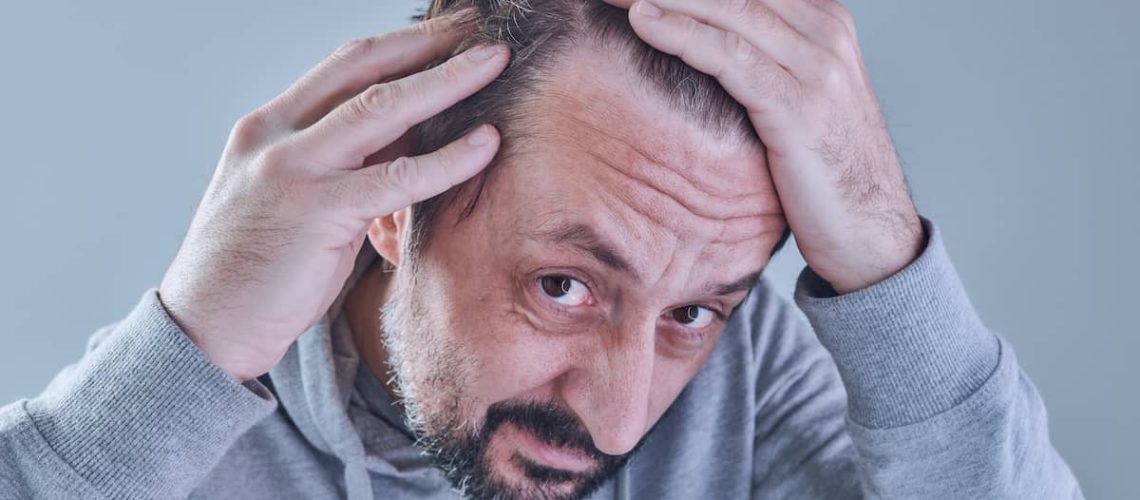 Man looking at hairline to see if he has frontal fibrosing alopecia