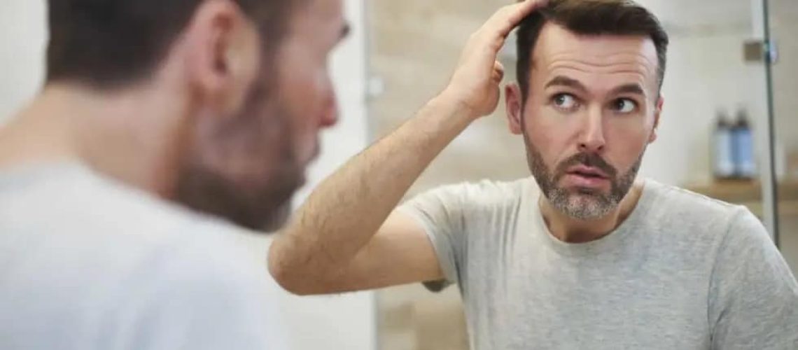 Hair transplant for receding hairline
