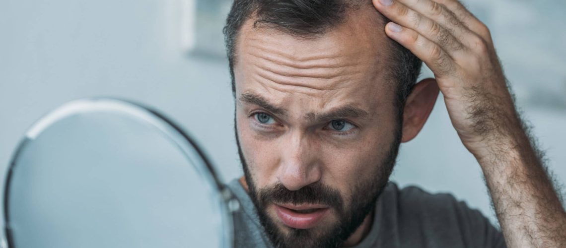 Jak naprawić zły przeszczep włosów?