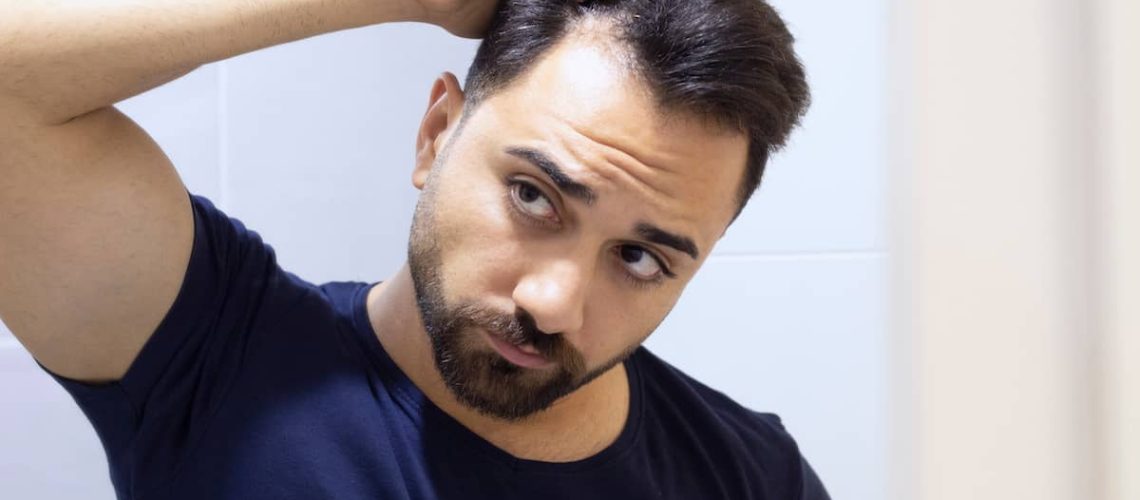 Why Do Hair Transplants Fail 7 Facts You Must Know