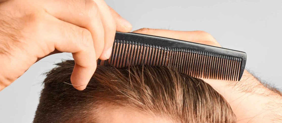 Мужчина расчесывает волосы и проверяет результат первой неудачной пересадки волос